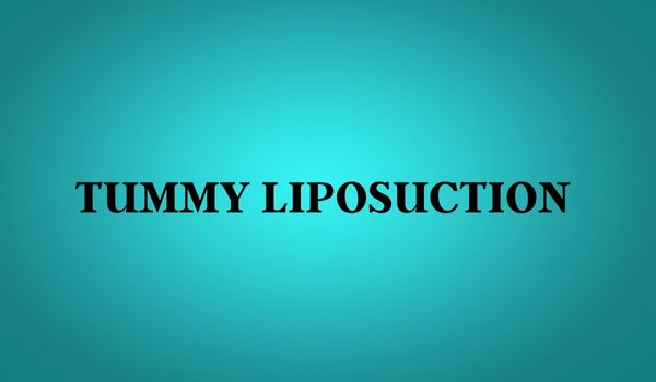 Tummy liposuction