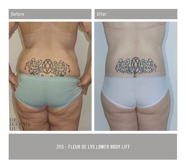 3155_back_fleur de lys_dr jeremy hunt