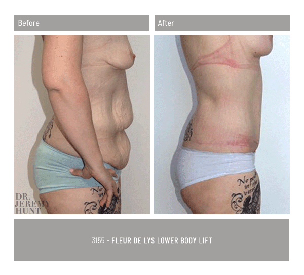 3155_side_fleur de lys_dr jeremy hunt_